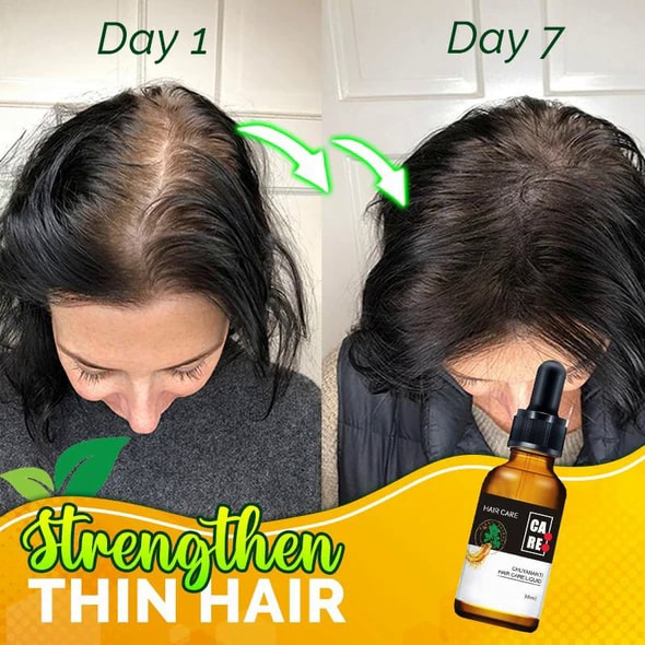 10X-Regro erős hajszérum