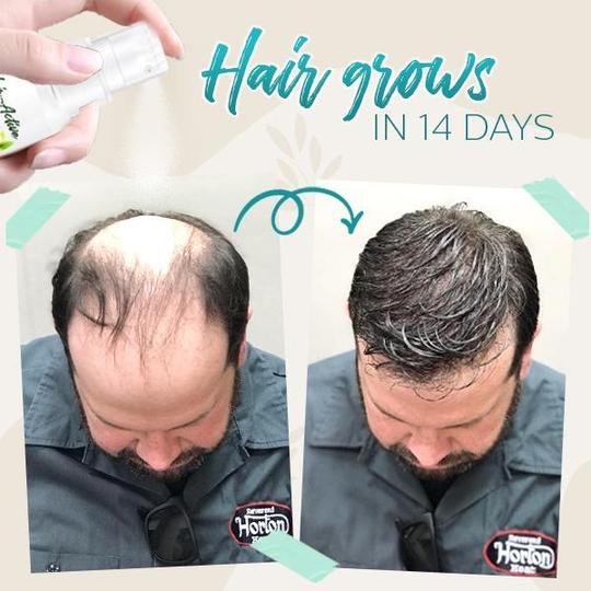 Hair-Active Root-Boost gyömbér spray - Image 2