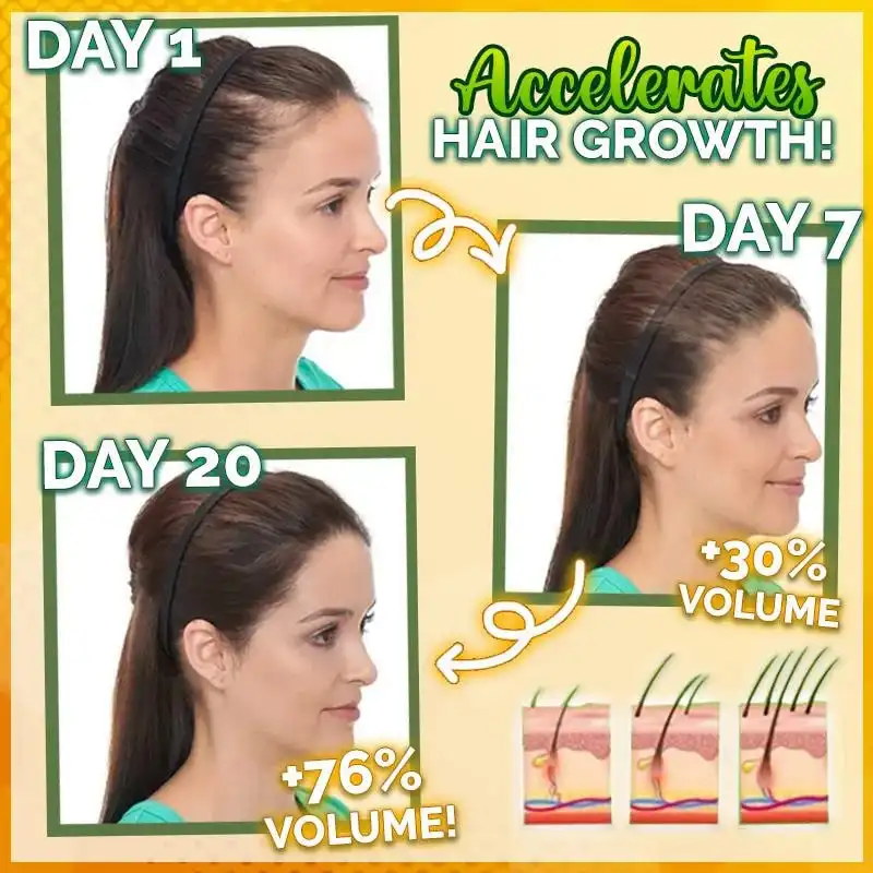 10X-Regro erős hajszérum - Image 2