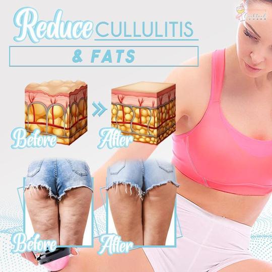 Slimology Detox Masszázs Ball - Image 3