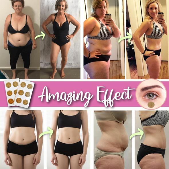 Akupresszúrás karcsúsító szemtapasz - Image 3