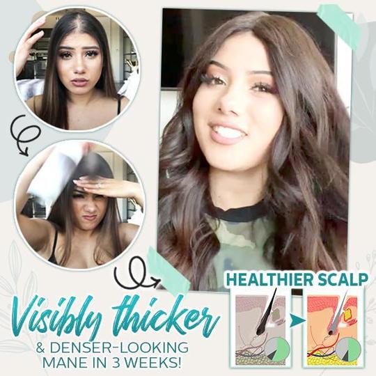 Hair-Active Root-Boost gyömbér spray - Image 4