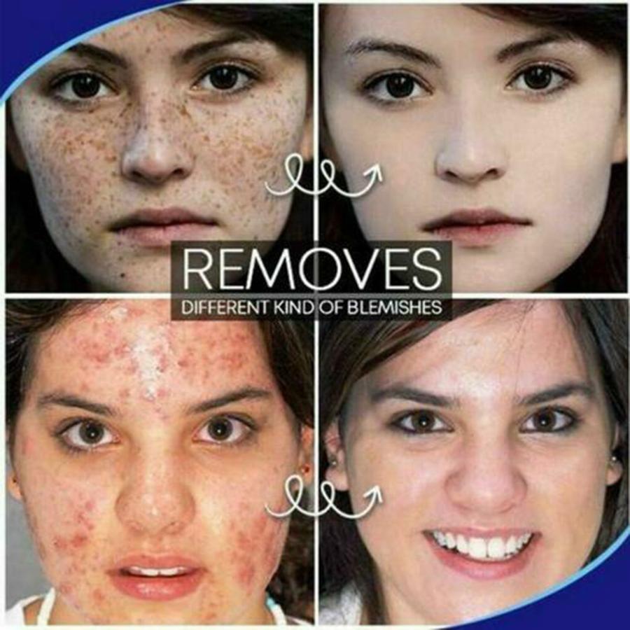 TagOut folteltávolító krém - Image 4