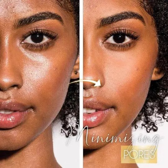 Dr. W Zero Pore szérum - Image 4