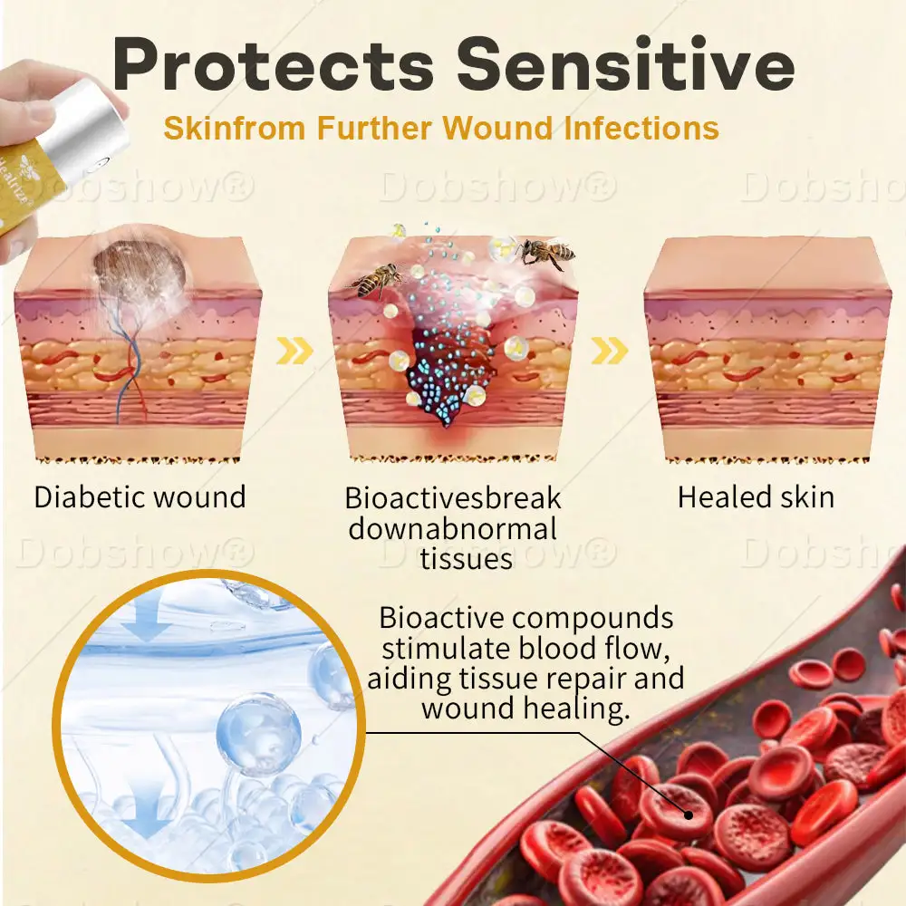 GlucoShield méhméreg sebspray - Image 3