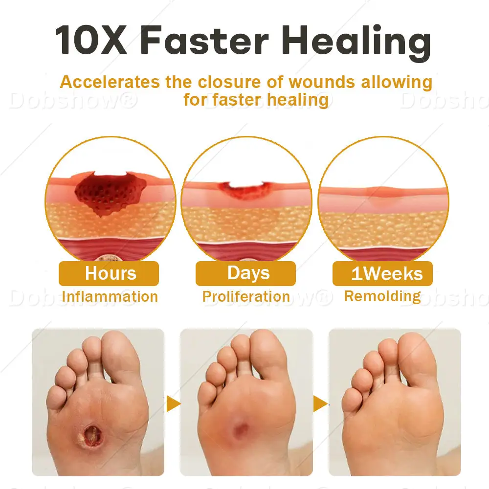 GlucoShield méhméreg sebspray - Image 4