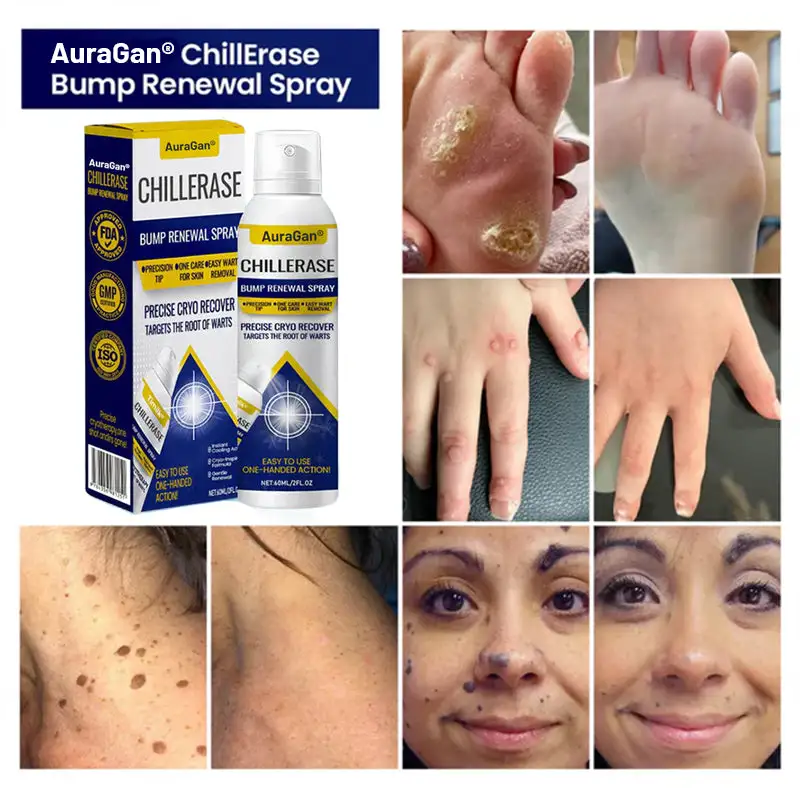 ChillErase dudormegújító spray - Image 4