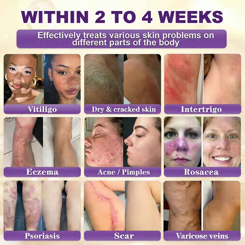 Biotin 10 az 1-ben bőrhelyreállító krém - Image 2