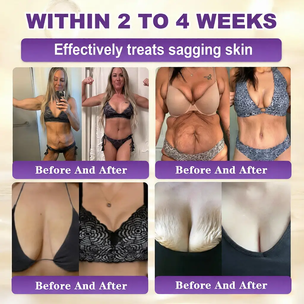 Biotin 10 az 1-ben bőrhelyreállító krém - Image 3