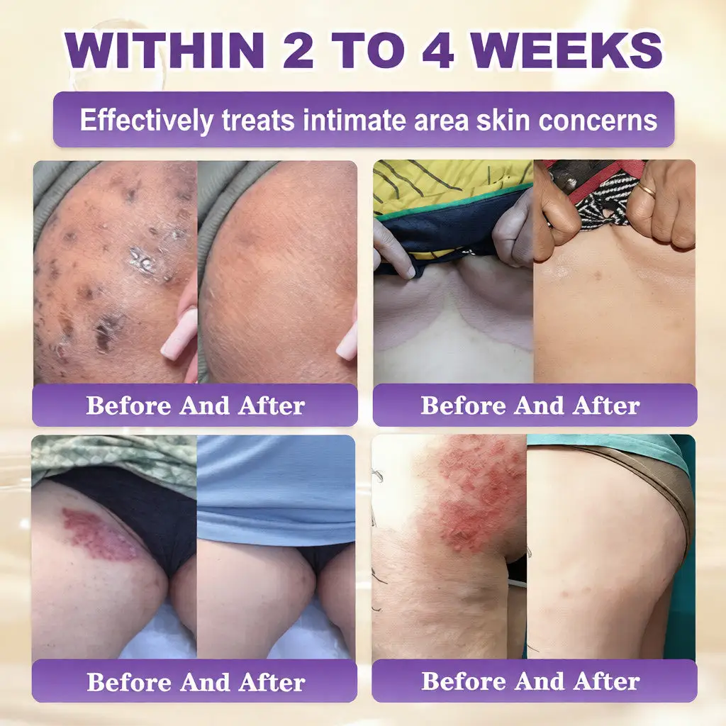 Biotin 10 az 1-ben bőrhelyreállító krém - Image 4