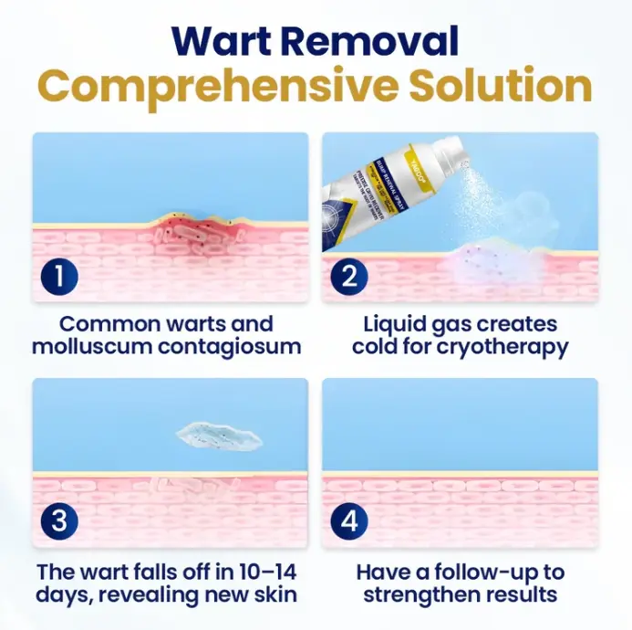 Chillique dudormegújító spray - Image 3